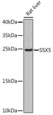 Western Blot: SSX5 Antibody [NBP2-93409] - Western blot analysis of extracts of Rat liver, using SSX5 Rabbit pAb (NBP2-93409) at 1:1000 dilution. Secondary antibody: HRP Goat Anti-Rabbit IgG (H+L) at 1:10000 dilution. Lysates/proteins: 25ug per lane. Blocking buffer: 3% nonfat dry milk in TBST. Detection: ECL Basic Kit. Exposure time: 90s.